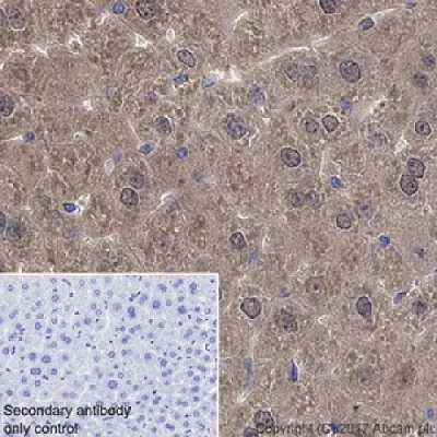 Immunohistochemistry (Formalin/PFA-fixed paraffin-embedded sections) - Anti-liver FABP antibody [EPR20464] - BSA and Azide free (AB240401)