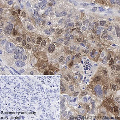 Immunohistochemistry (Formalin/PFA-fixed paraffin-embedded sections) - Anti-liver FABP antibody [EPR20464] - BSA and Azide free (AB240401)
