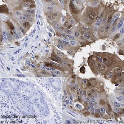 Immunohistochemistry (Formalin/PFA-fixed paraffin-embedded sections) - Anti-liver FABP antibody [EPR20464] - BSA and Azide free (AB240401)