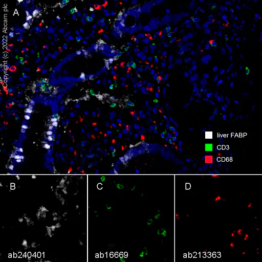 Multiplex immunohistochemistry - Anti-liver FABP antibody [EPR20464] - BSA and Azide free (AB240401)