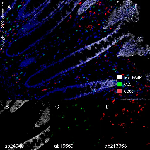 Multiplex immunohistochemistry - Anti-liver FABP antibody [EPR20464] - BSA and Azide free (AB240401)