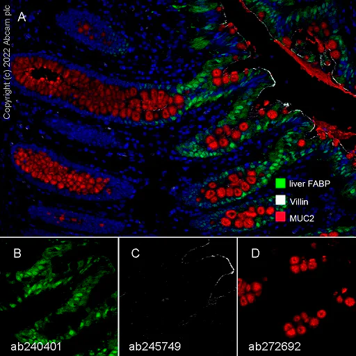 Multiplex immunohistochemistry - Anti-liver FABP antibody [EPR20464] - BSA and Azide free (AB240401)