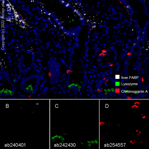 Multiplex immunohistochemistry - Anti-liver FABP antibody [EPR20464] - BSA and Azide free (AB240401)