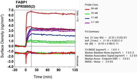 OI-RD Scanning - Anti-liver FABP antibody [EPR5895(2)] (AB129203)