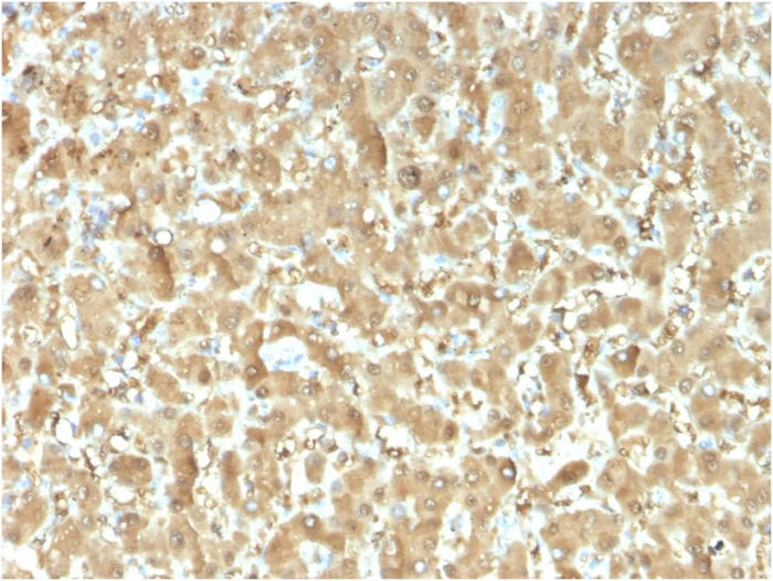 Immunohistochemistry (Formalin/PFA-fixed paraffin-embedded sections) - Anti-liver FABP antibody [FABP1/3482] (AB268055)