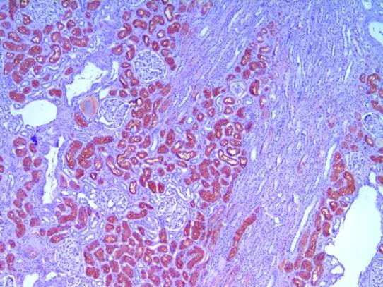 Immunohistochemistry (Formalin/PFA-fixed paraffin-embedded sections) - Anti-liver FABP antibody [L2B10] (AB7366)