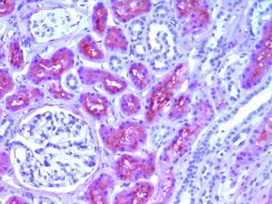Immunohistochemistry (Formalin/PFA-fixed paraffin-embedded sections) - Anti-liver FABP antibody [L2B10] (AB7366)
