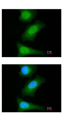 Immunocytochemistry/ Immunofluorescence - Anti-Livin antibody (AB97350), expandable thumbnail