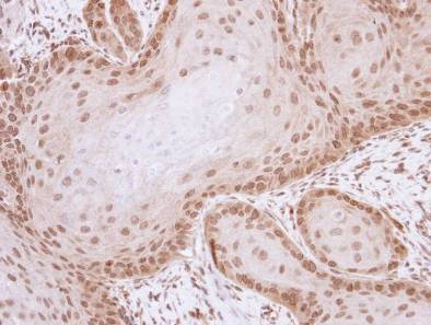 Immunohistochemistry (Formalin/PFA-fixed paraffin-embedded sections) - Anti-Livin antibody (AB97350), expandable thumbnail