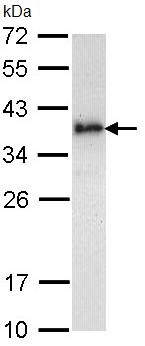 Western blot - Anti-Livin antibody (AB97350), expandable thumbnail