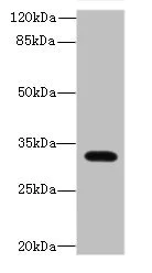 Western blot - Anti-LIX1 antibody (AB235524)