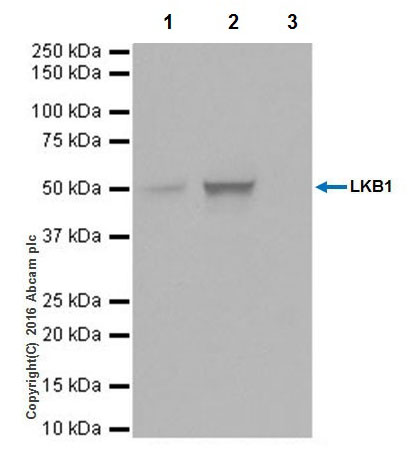 Immunoprecipitation - Anti-LKB1 antibody [EPR19379] (AB199970), expandable thumbnail