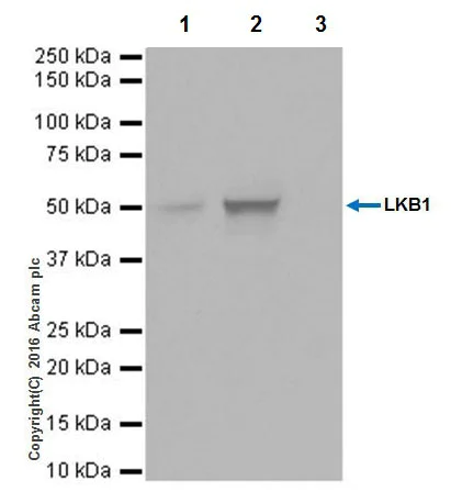 Immunoprecipitation - Anti-LKB1 antibody [EPR19379] (AB199970)