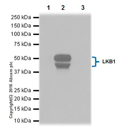 Immunoprecipitation - Anti-LKB1 antibody [EPR19379] (AB199970)