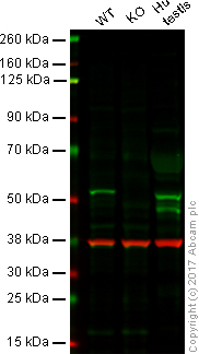 Western blot - Anti-LKB1 antibody [EPR19379] (AB199970), expandable thumbnail