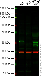 Western blot - Anti-LKB1 antibody [EPR19379] (AB199970)