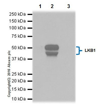 Immunoprecipitation - Anti-LKB1 antibody [EPR19379] - BSA and Azide free (AB223146)