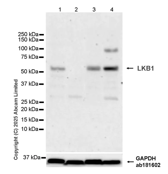 Western blot - Anti-LKB1 antibody [EPR30544-80] (AB325326)