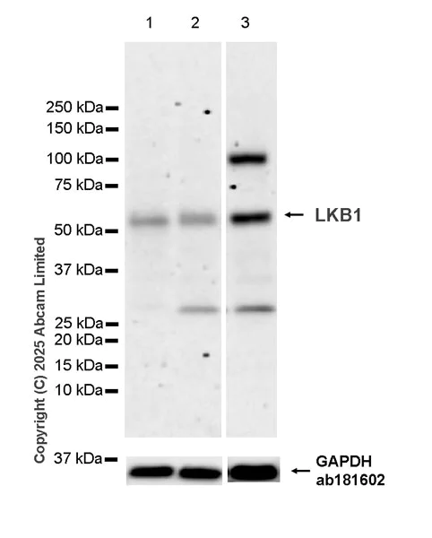 Western blot - Anti-LKB1 antibody [EPR30544-80] (AB325326)