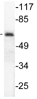 Western blot - Anti-LKB1 (phospho S428) antibody (AB138386)