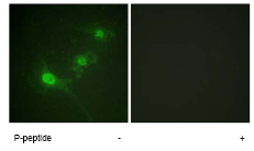 Immunocytochemistry/ Immunofluorescence - Anti-LKB1 (phospho S428) antibody (AB63473), expandable thumbnail