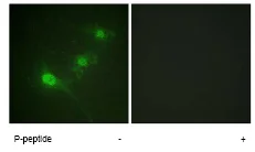 Immunocytochemistry/ Immunofluorescence - Anti-LKB1 (phospho S428) antibody (AB63473)
