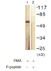 Western blot - Anti-LKB1 (phospho T189) antibody (AB60987)