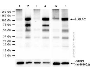 Western blot - Anti-LLGL1 + LLGL2 antibody [EPR18899] - BSA and Azide free (AB250640)