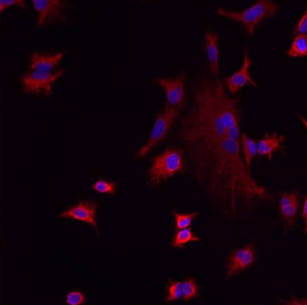 Immunocytochemistry/ Immunofluorescence - Anti-LMAN1 antibody (AB32583), expandable thumbnail