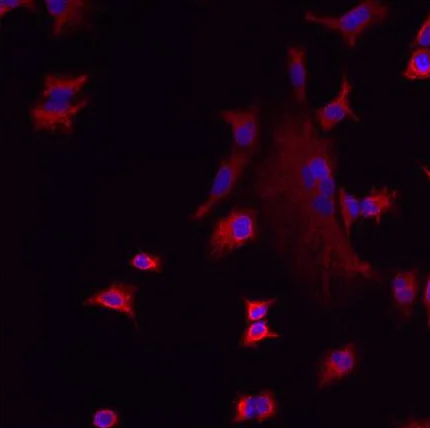 Immunocytochemistry/ Immunofluorescence - Anti-LMAN1 antibody (AB32583)