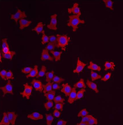 Immunocytochemistry/ Immunofluorescence - Anti-LMAN1 antibody (AB32583), expandable thumbnail