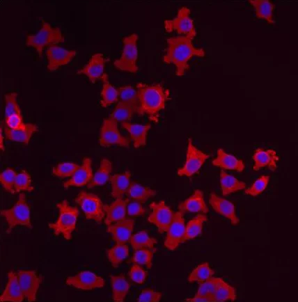 Immunocytochemistry/ Immunofluorescence - Anti-LMAN1 antibody (AB32583)