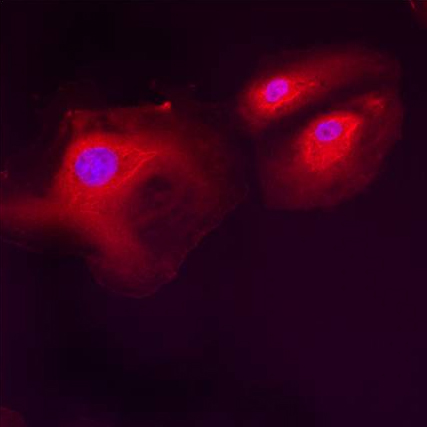 Immunocytochemistry/ Immunofluorescence - Anti-LMAN1 antibody (AB32583), expandable thumbnail