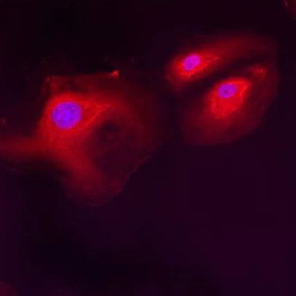 Immunocytochemistry/ Immunofluorescence - Anti-LMAN1 antibody (AB32583)