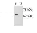 Western blot - Anti-LMAN1 antibody (AB32583)