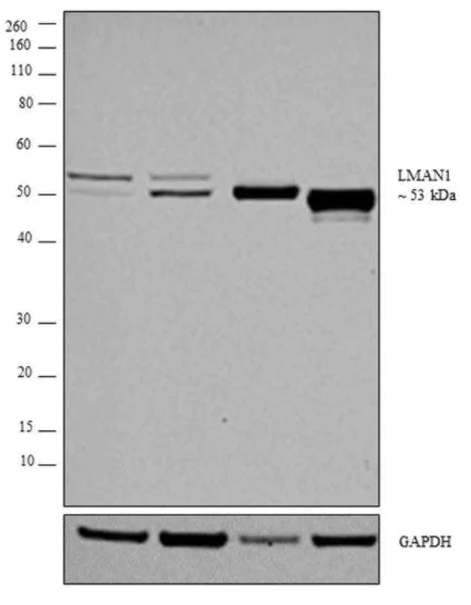 Western blot - Anti-LMAN1 antibody (AB32583)