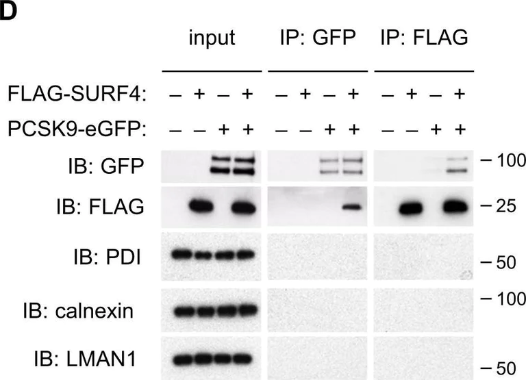 Western blot - Anti-LMAN1 antibody [EPR6979] (AB125006)