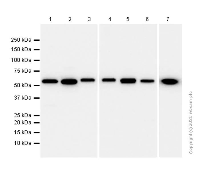 Western blot - Anti-LMAN1 antibody [EPR6979] (AB125006)