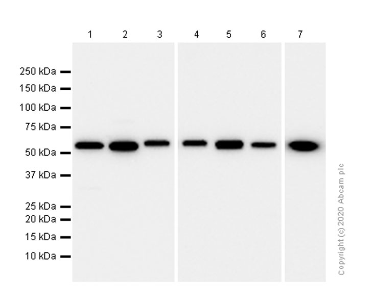 Western blot - Anti-LMAN1 antibody [EPR6979] - BSA and Azide free (AB248096), expandable thumbnail