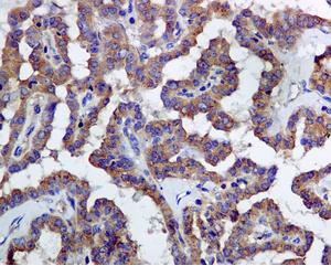 Immunohistochemistry (Formalin/PFA-fixed paraffin-embedded sections) - Anti-LMAN1 antibody [EPR6980] (AB126720), expandable thumbnail