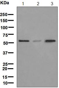 Western blot - Anti-LMAN1 antibody [EPR6980] (AB126720), expandable thumbnail