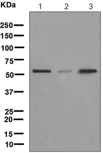 Western blot - Anti-LMAN1 antibody [EPR6980] (AB126720)