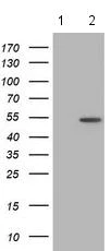 Western blot - Anti-LMAN1 antibody [OTI1B8] (AB118407)