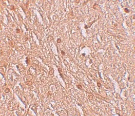 Immunohistochemistry (Formalin/PFA-fixed paraffin-embedded sections) - Anti-LMBRD1 antibody (AB105419)