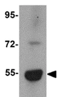Western blot - Anti-LMBRD1 antibody (AB105419)