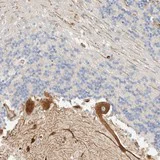 Immunohistochemistry (Formalin/PFA-fixed paraffin-embedded sections) - Anti-LMCD1 antibody (AB121788)