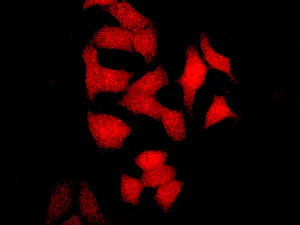 Immunocytochemistry/ Immunofluorescence - Anti-LMCD1 antibody [EPR11444] - BSA and Azide free (AB242401)