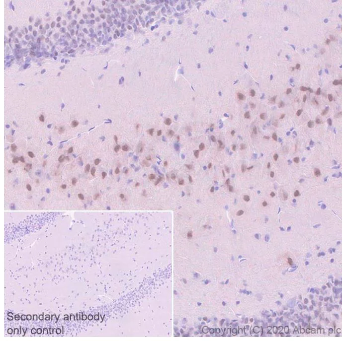 Immunohistochemistry (Formalin/PFA-fixed paraffin-embedded sections) - Anti-LMO 4 antibody [20F8] (AB243139)
