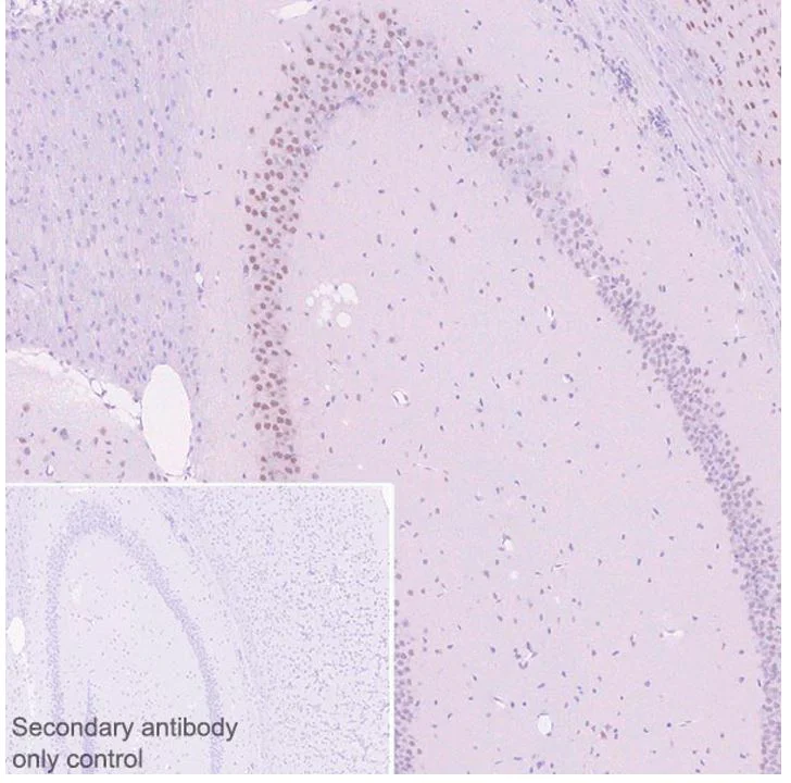 Immunohistochemistry (Formalin/PFA-fixed paraffin-embedded sections) - Anti-LMO 4 antibody [20F8] (AB243139)