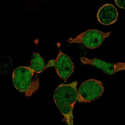 Immunocytochemistry/ Immunofluorescence - Anti-LMO2 antibody (AB219995)